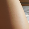 découvrez comment les traitements esthétiques peuvent aider à réduire la cellulite et améliorer l'apparence de votre peau pour une silhouette plus lisse et tonique.